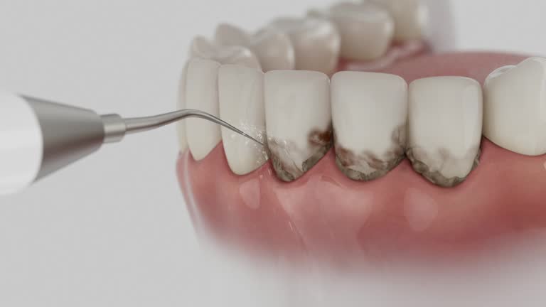Trusted Root Canal Treatment service in Liberty, UT - Dentist Open Now